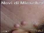 neoformazioni viso prima